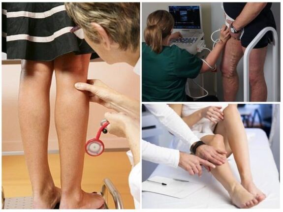 Varicose veins- ի ախտորոշում