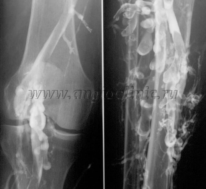 Ուլտրաձայնային սկանավորում